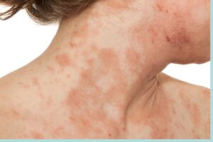 Black Neck: 7 Causes and How to Get Rid of it