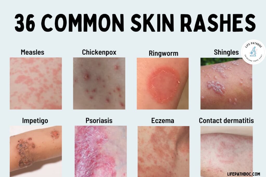 Dry Orange Rash Causes Symptoms And Effective Management