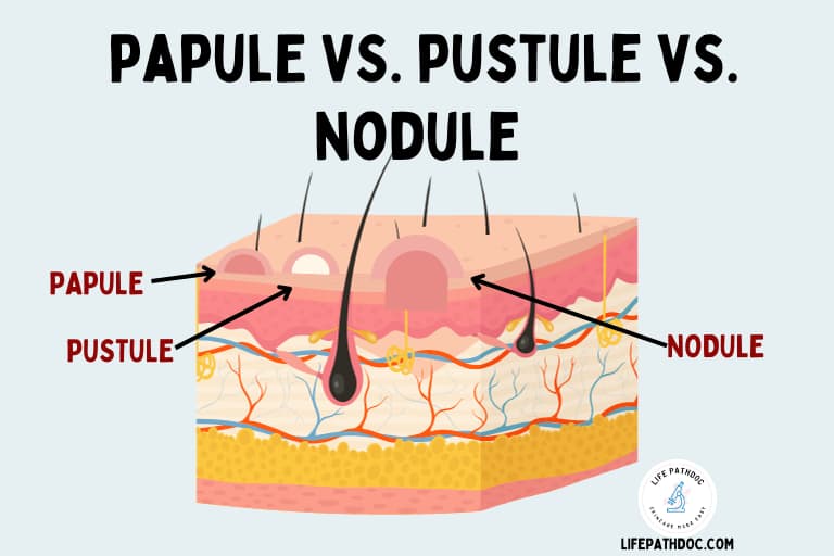 Papule Vs Pustule Vs Nodule Pictures Differences And Causes